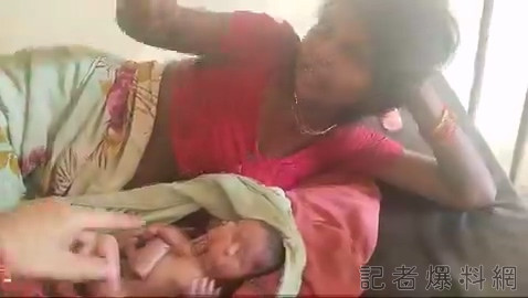 影／嬰兒4隻手腳2張臉！印度女產下奇特孩子　生出5小時後死亡