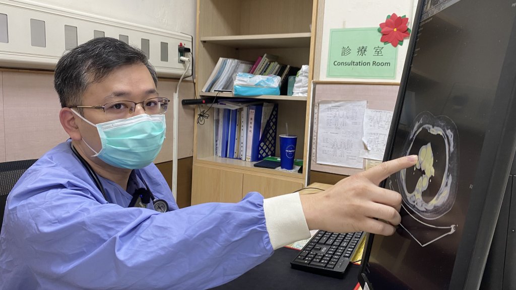 65歲女性背痛竟是主動脈剝離，醫師提醒天氣炎熱會提高風險