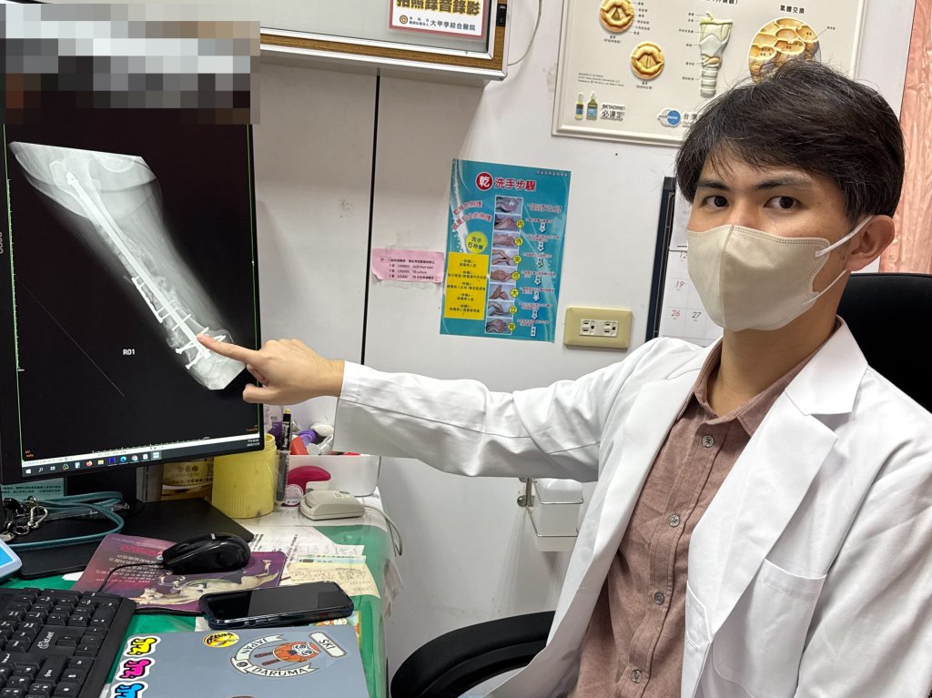 8旬翁大腿斷三截 三次術後喊「我要再參加媽祖遶境」