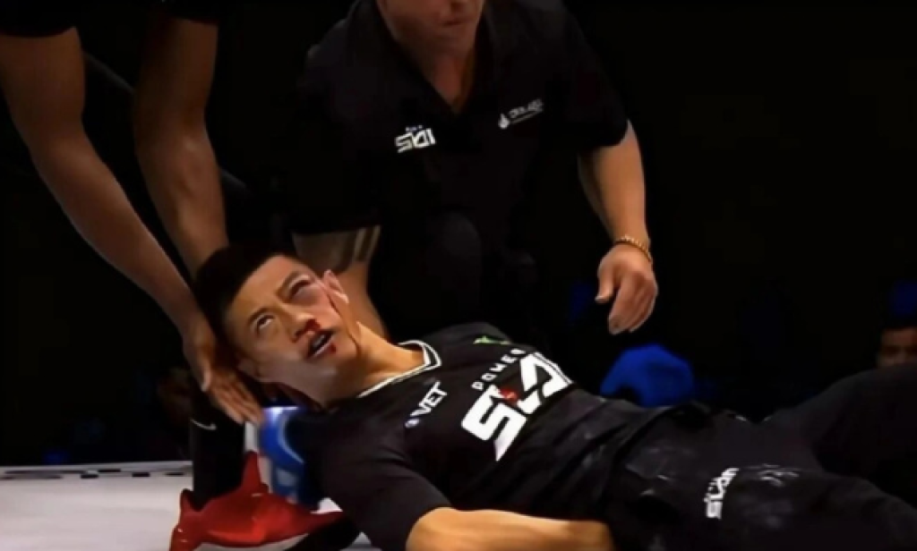 影/中國通背拳傳人「打巴掌比賽」被KO 視力受損看東西多重影!醫生:手術也難以完全恢復