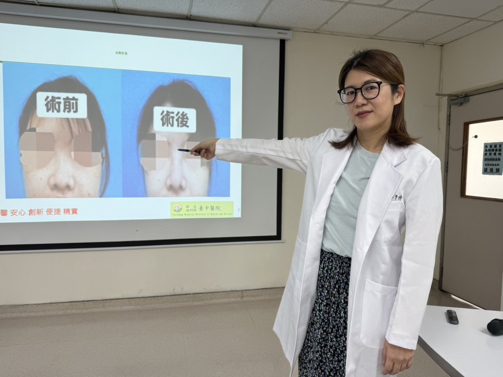 蘋果姐姐遇車禍撞歪鼻子 這手術讓她重建堅挺鼻樑大口呼吸