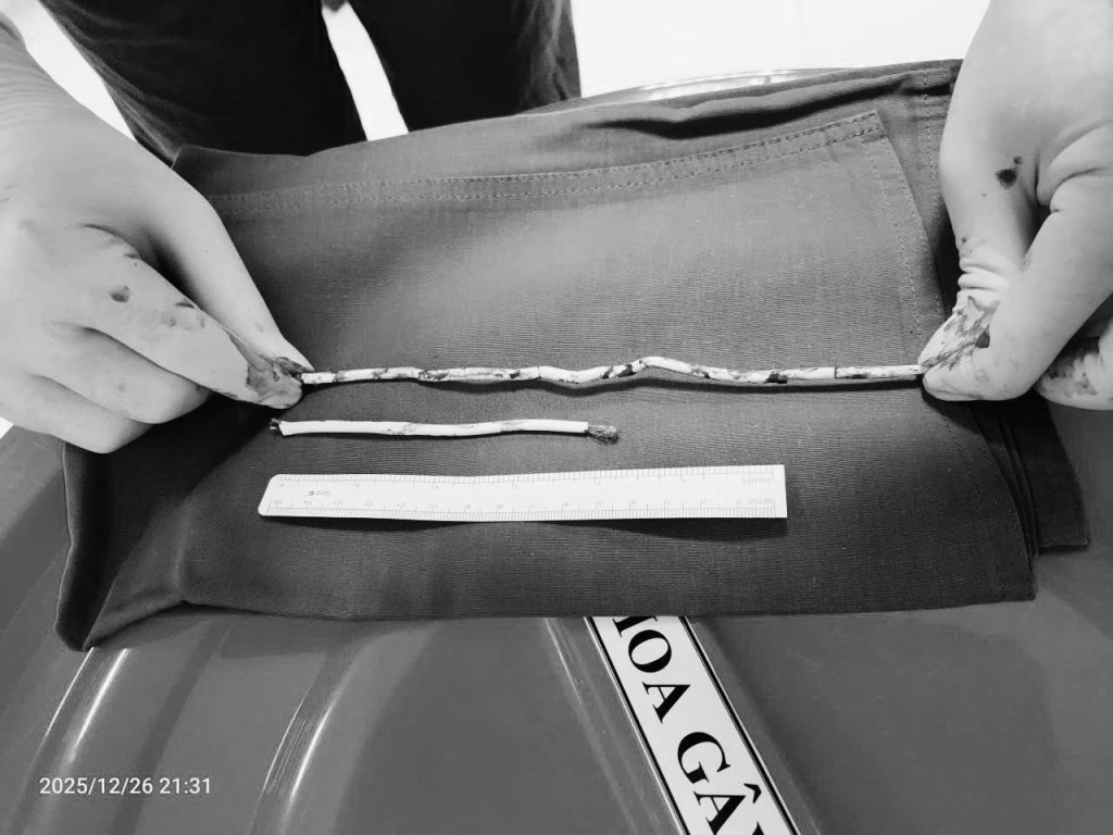 這也敢試！15歲少年看網路影片拿「35公分網路線」塞進尿道　醫緊急切開取出