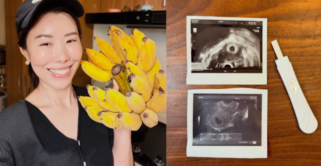 網紅金老佛爺45歲懷3寶流產！「是不是我年紀太大了」