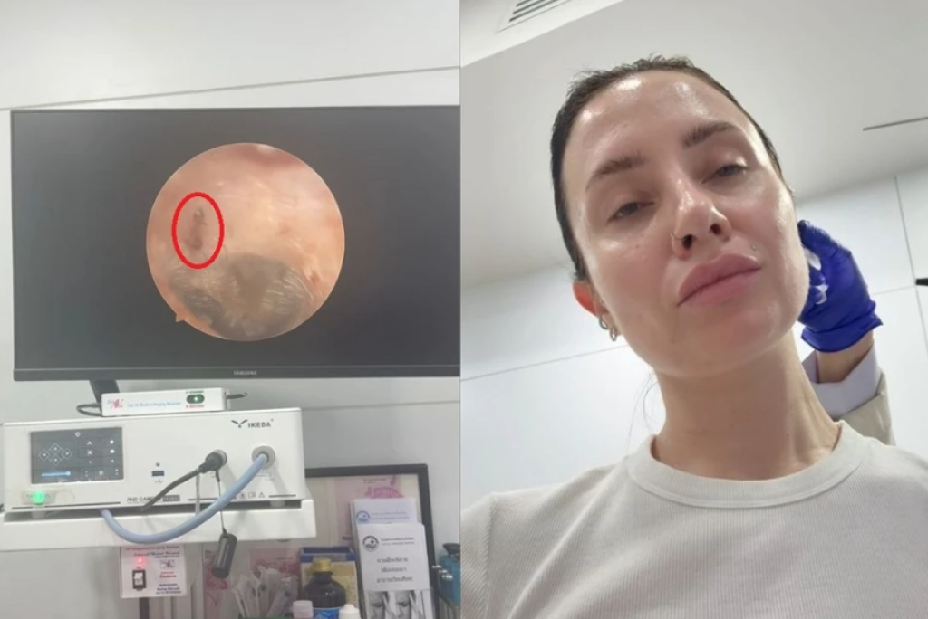 影／凌晨4點驚醒！正妹泰國度假「耳朵傳出蠕動聲」　醫一照「螞蟻在爬」影片曝光